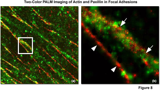 Super Resolution Microscopy (STED, SIM, PALM, STORM)