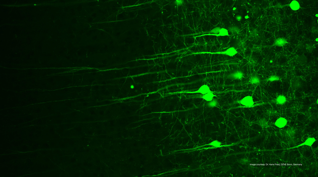 Image: Dr. Hans-Ulrich Fried, DZNE Bonn, Germany