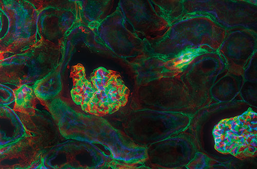 Biophotonics & Microscopy 