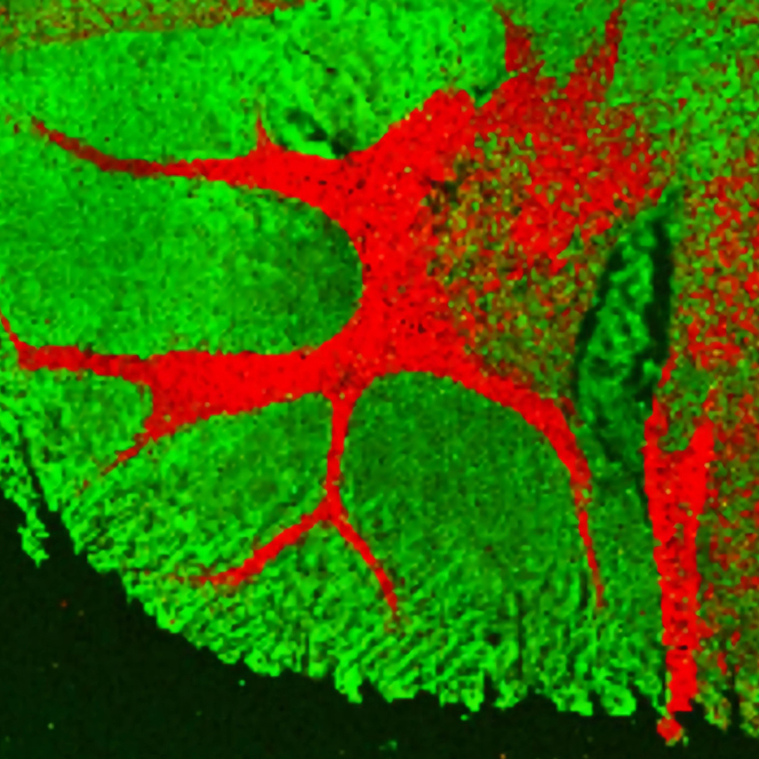 Microlithography, direct laser writing, mask writing