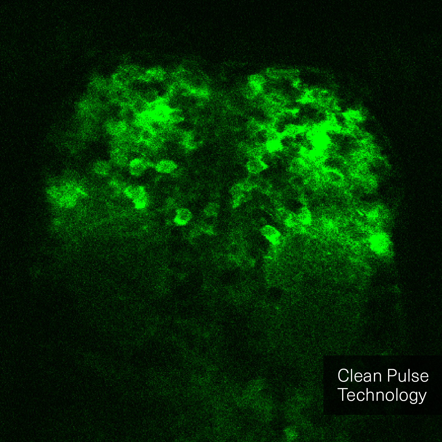 The image is a comparative visualization showing the difference between two microscopy techniques. On the left side, labeled "without Clean Pulse Technology," the image appears darker and less detailed. On the right side, labeled "with Clean Pulse Technology," the image is brighter and shows more distinct and clear details of the microscopic sample. A vertical line divides the two halves, with a circular icon featuring arrows pointing left and right at the center, indicating the comparison. The background of both sides is green, highlighting the improvements in image clarity and brightness achieved with Clean Pulse Technology.
