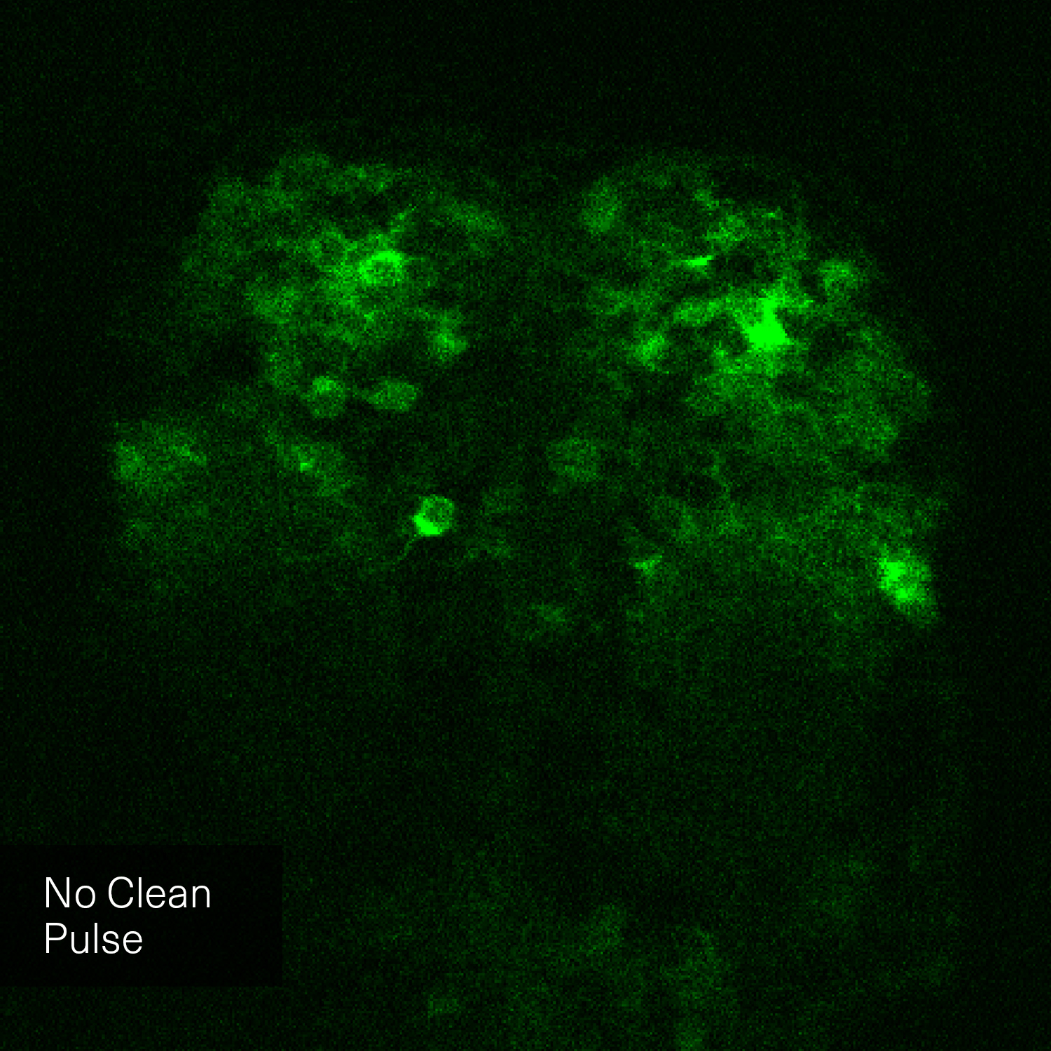The image is a comparative visualization showing the difference between two microscopy techniques. On the left side, labeled "without Clean Pulse Technology," the image appears darker and less detailed. On the right side, labeled "with Clean Pulse Technology," the image is brighter and shows more distinct and clear details of the microscopic sample. A vertical line divides the two halves, with a circular icon featuring arrows pointing left and right at the center, indicating the comparison. The background of both sides is green, highlighting the improvements in image clarity and brightness achieved with Clean Pulse Technology.