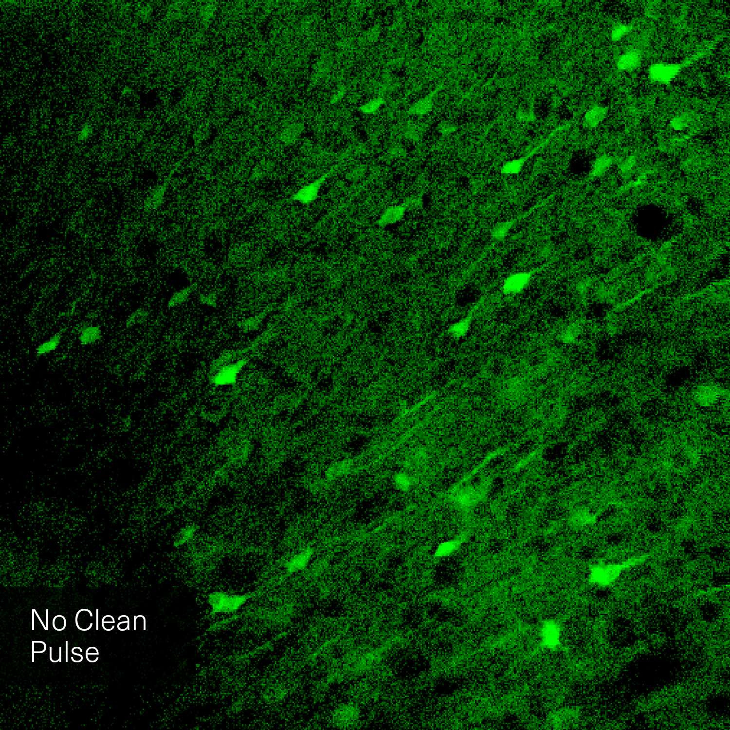 The image is a comparative visualization showing the difference between two microscopy techniques. On the left side, labeled "without Clean Pulse Technology," the image appears darker and less detailed. On the right side, labeled "with Clean Pulse Technology," the image is brighter and shows more distinct and clear details of the microscopic sample. A vertical line divides the two halves, with a circular icon featuring arrows pointing left and right at the center, indicating the comparison. The background of both sides is green, highlighting the improvements in image clarity and brightness achieved with Clean Pulse Technology.
