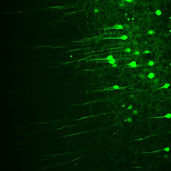 Two-photon imaging of GFP-labelled neurons from mouse brain.  Image courtesy: Dr. Hans Fried, DZNE Bonn, Germany