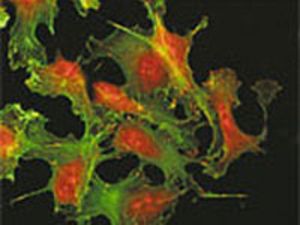 Confocal Microscopy