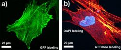 FemtoFiber ultra 920を使用した二光子顕微鏡画像。a、アクチンネットワークに結合したGFPを発現するヒト幹細胞の画像。b, アクチンネットワークのATTO594標識および細胞核のDAPI標識を有するヒト幹細胞。すべての画像はミュンヘンの応用科学大学のThomas Hellerer教授の研究グループ御提供。